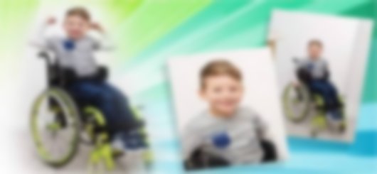 Hereditary spastic paraparesis Hereditary spastic paraparesis